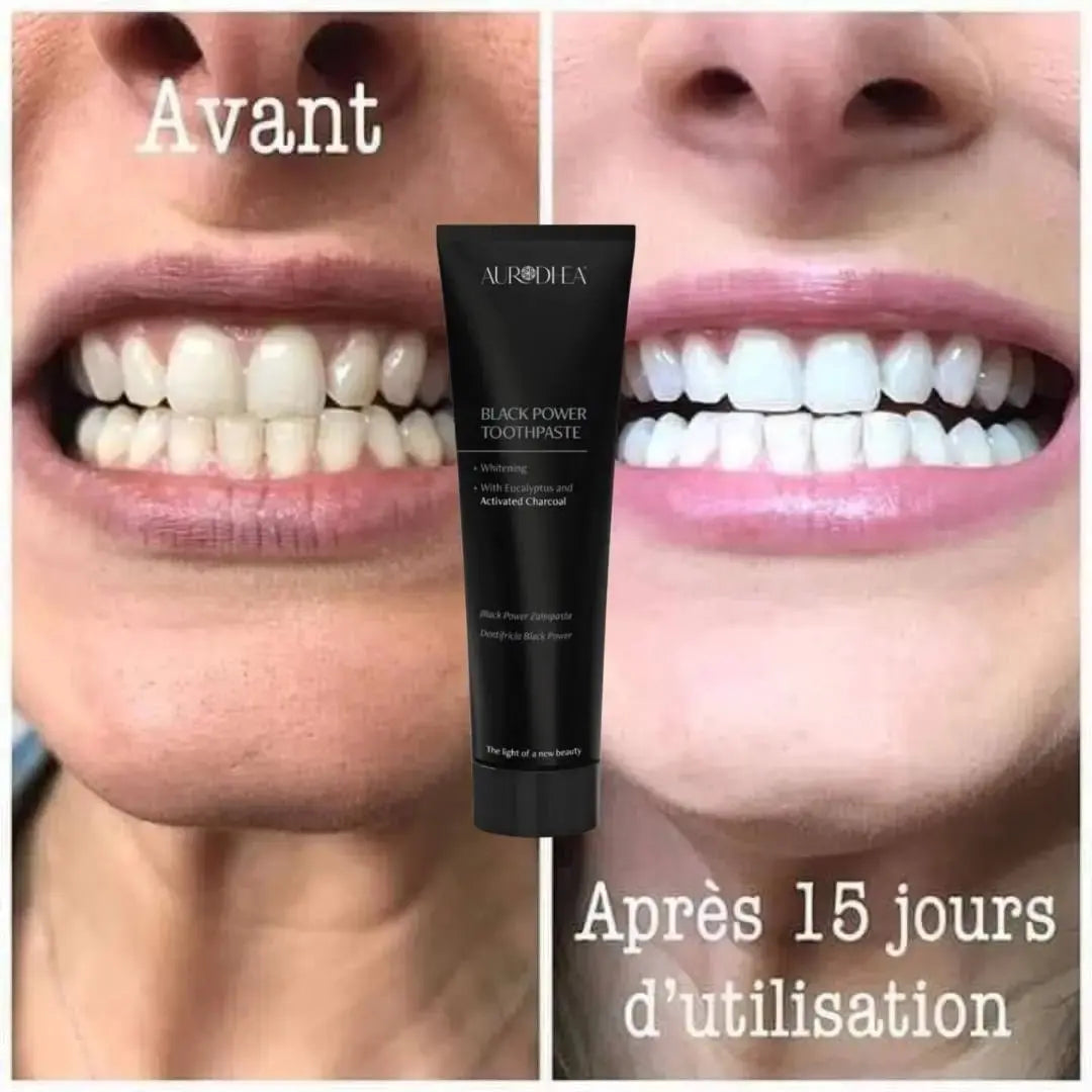 DENTIFRICE BLACK POWER AU CHARBON ACTIF AVEC BROSSE A DENTS A NANOTECHNOLOGIE - AURA PHENIX