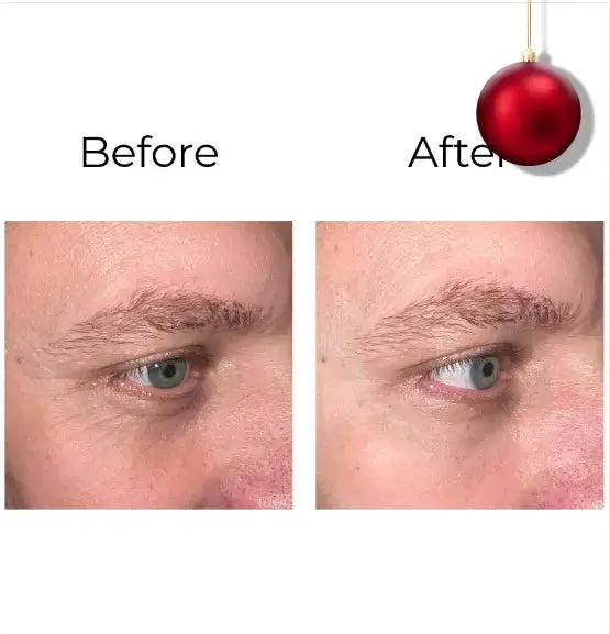 PEPTILUX CRÈME YEUX SHOCK ACTION – EFFET LIFTING IMMÉDIAT, ANTI-RIDES & REGARD REPULPÉ 6–10H - AURA PHENIX