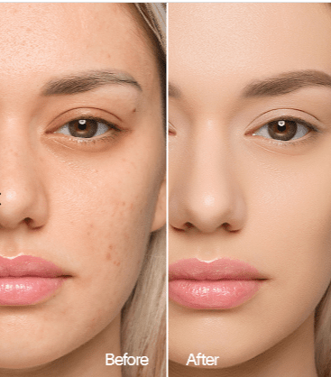 COUVRANCE LISSANTE + SPF 30 : LE SECRET D’UN TEINT ZÉRO DÉFAUT - AURA PHENIX